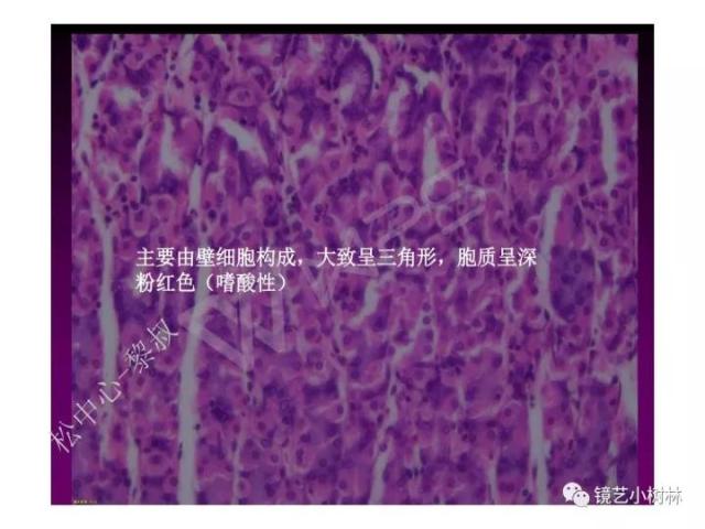 上消化道早癌病理的学习心得体会（附胃牵手癌的病例特点文献学习）