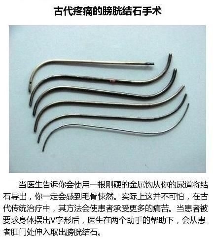 古代令人意想不到的治疗方式 你不能错过哟！