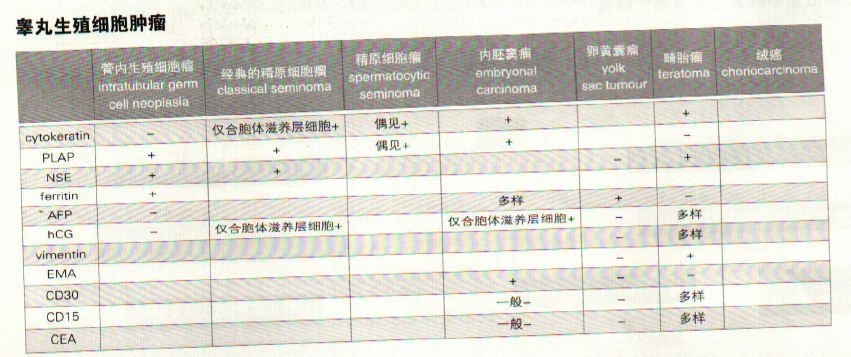 睾丸生殖细胞肿瘤