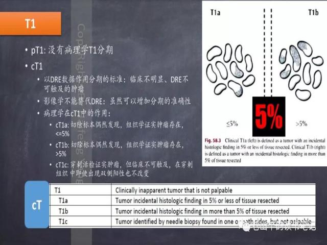 AJCC第8版 前列腺癌分期 之 病理学要点