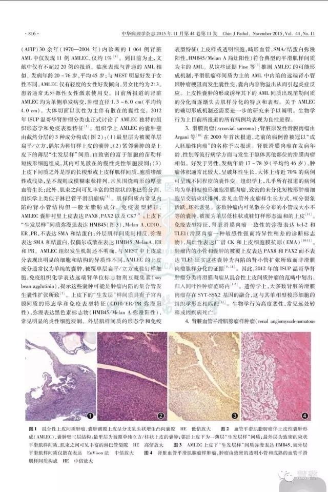 囊性肾瘤（杨倩分享，王哲老师等讲解及讨论）