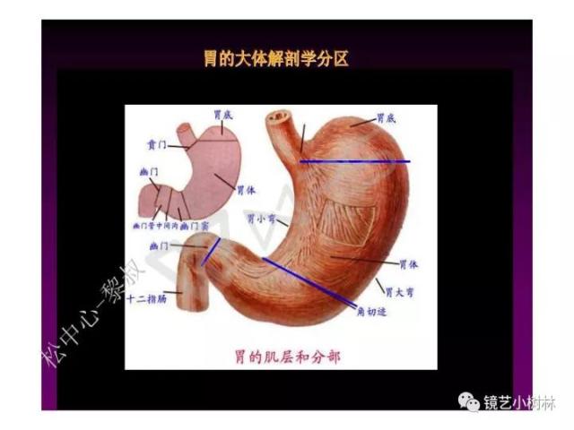 上消化道早癌病理的学习心得体会（附胃牵手癌的病例特点文献学习）