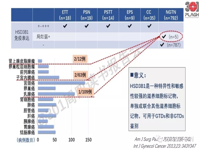中间型滋养细胞肿瘤的诊断及鉴别诊断
