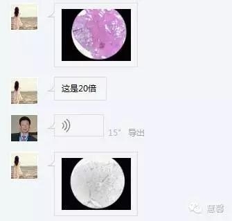 前列腺腺癌？（芳分享病例，华夏泌尿群讨论，孔祥田老师讲解）