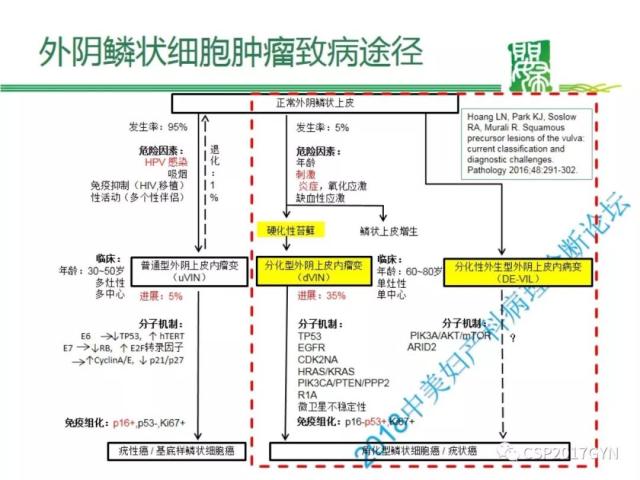 非HPV相关的外阴鳞状细胞肿瘤