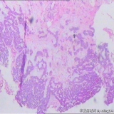 2012-06-21