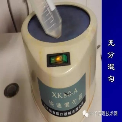 免疫组化液态阳性对照