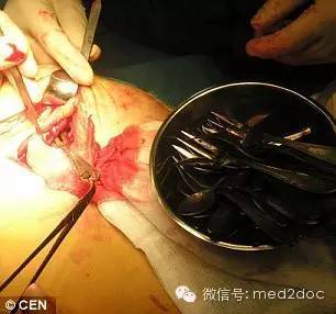 这张奇异的X线片是什么？诊断结果令人瞠目结舌......