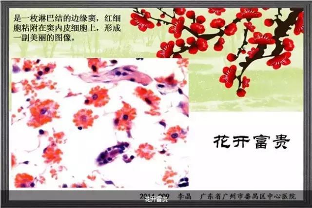 你见过这么美的病理切片吗？