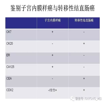 卵巢癌的病理诊断新进展（二）