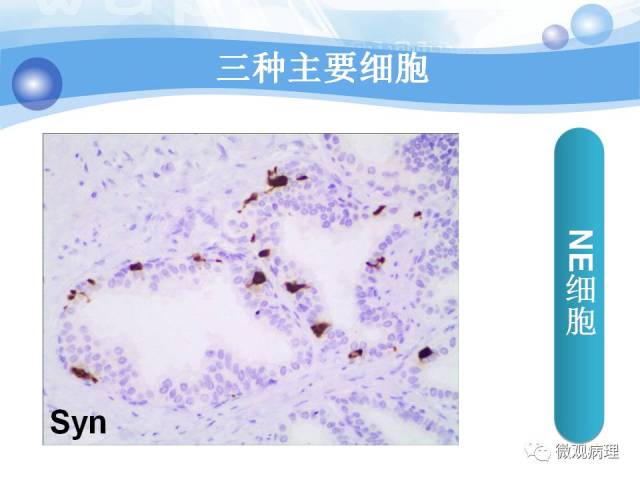 正常前列腺组织学