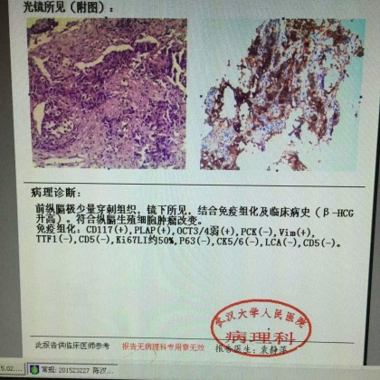病理科新技术（二）：穿刺组织学明确诊断