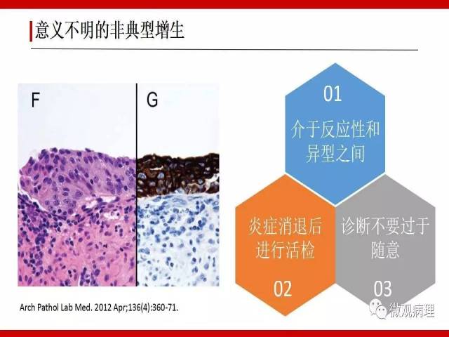膀胱尿路上皮肿瘤诊断的一些困惑