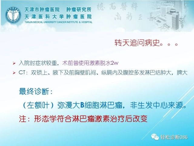 中枢神经系统弥漫大B细胞淋巴瘤