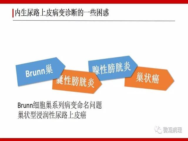 膀胱尿路上皮肿瘤诊断的一些困惑