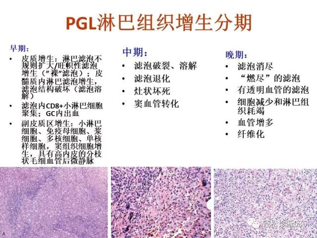 免疫缺陷相关淋巴组织增殖性疾病