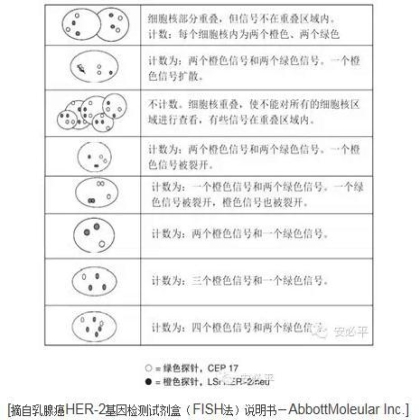 乳腺癌HER2 FISH检测——靶向用药的金标准(二)HER2 FISH检测结果判读