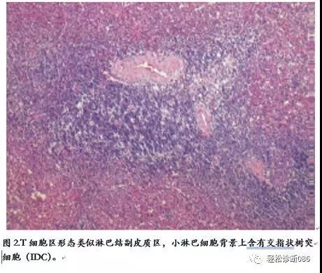 组织细胞起源疾病（1）——概述