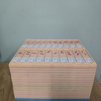 病理制片固定环节为什么是“不可逆的关键一步”