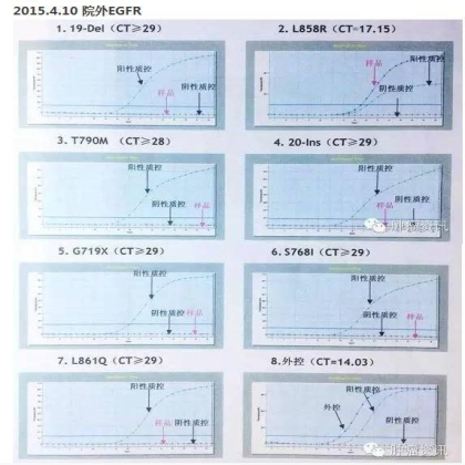 中日韩个体化诊疗案例大赛经典赏析之十四——27岁晚期NSCLC，精准治疗 与 指南盲区向左向右