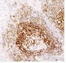 常用免疫组化指标在正常淋巴结中的表达（三）