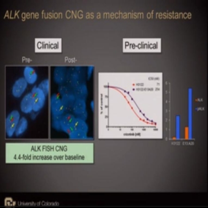 Analysis of resistance mechanisms to ALK kinase inhibitors in ALK+ NSCLC patients
