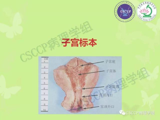 宫颈与子宫病变病理标本取材