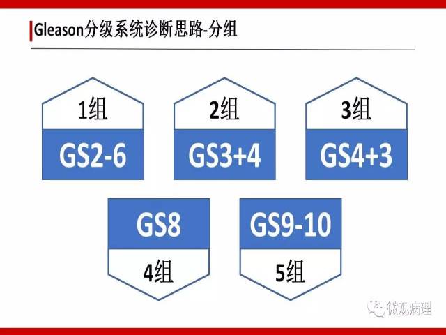 前列腺癌Gleason分级系统的前世今生