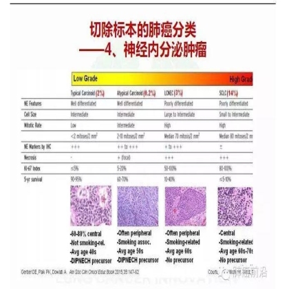 肺癌新分期和分类--临床和研究启示