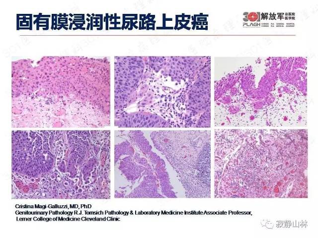 泌尿系统常见肿瘤标本病理报告规范