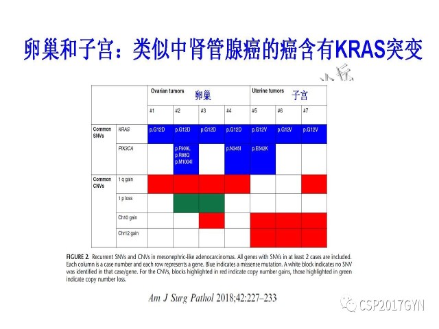 妇科肿瘤病理新进展——特殊类型的腺癌