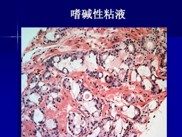 前列腺病理诊断线索（上）——黄教悌