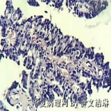2012-03-06