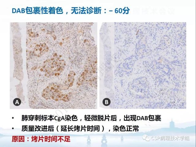 免疫组化检测的临床应用与质量评估
