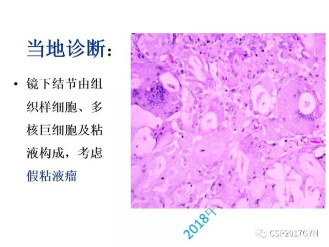 病理临床结合 开拓诊断视野