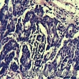 2012-03-06