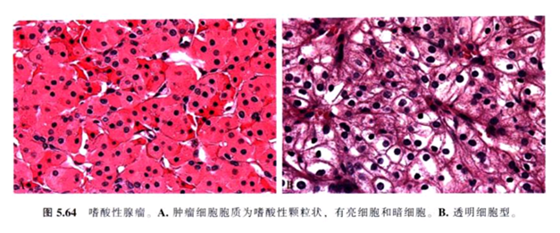 [ 连载 ] 上海肿瘤医院进修笔记 6