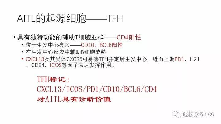 血管免疫母T细胞淋巴瘤