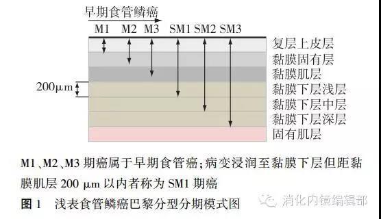中国早期食管鳞状细胞癌及癌前病变筛查 与诊治共识（2015年，北京）