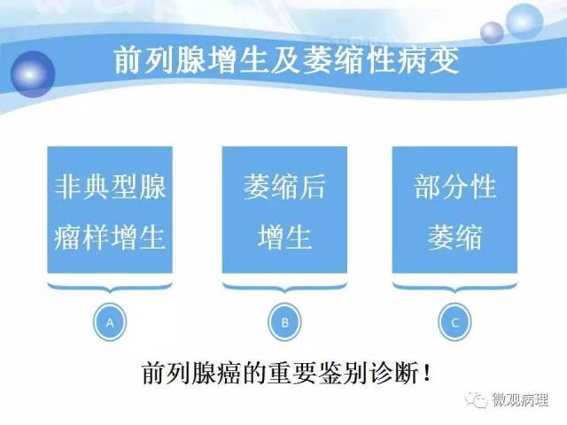 泌尿课程/局灶性前列腺萎缩