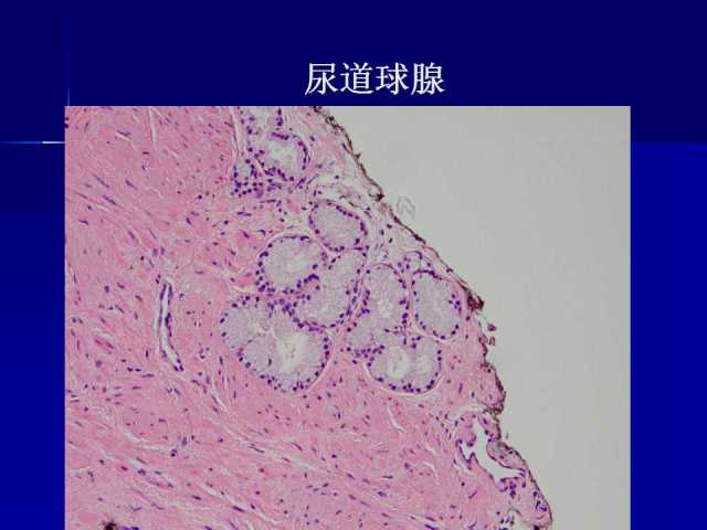 前列腺病理诊断线索（上）——黄教悌