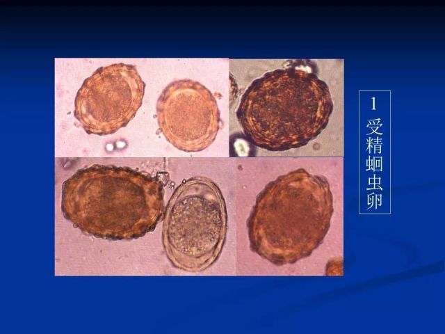 收藏！寄生虫图谱大全