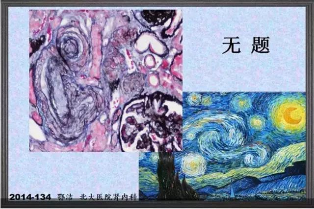 你见过这么美的病理切片吗？