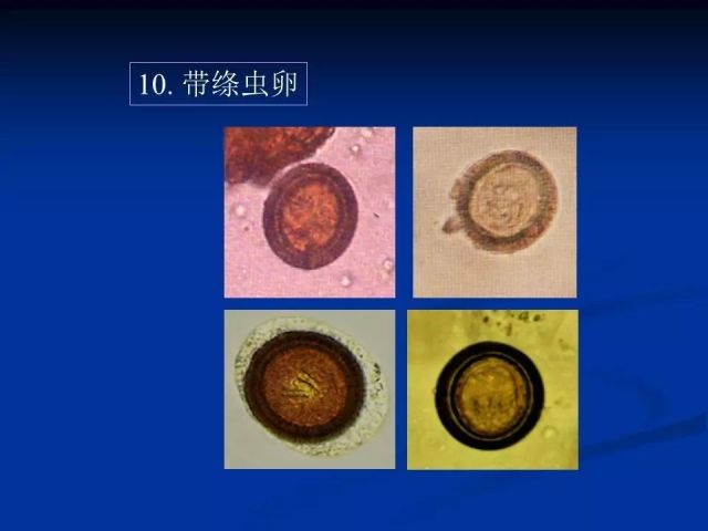 收藏！寄生虫图谱大全