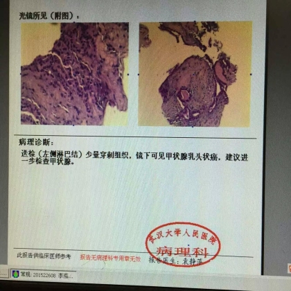 病理科新技术（二）：穿刺组织学明确诊断
