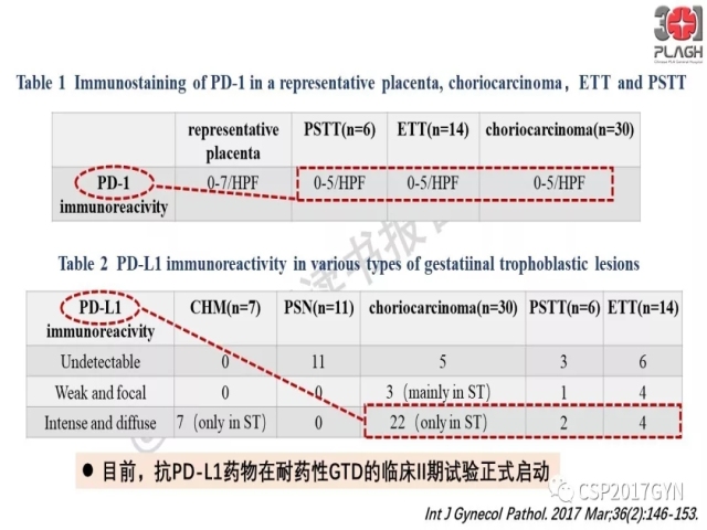 中间型滋养细胞肿瘤的诊断及鉴别诊断