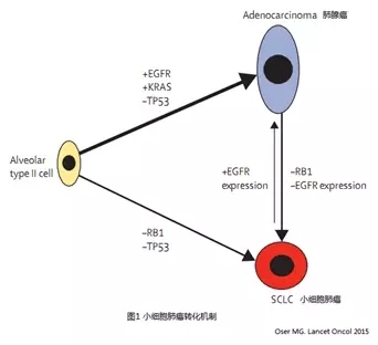 小细胞肺癌转化机制和治疗