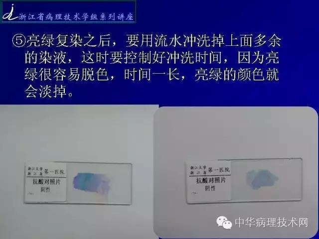 特殊染色-抗酸染色