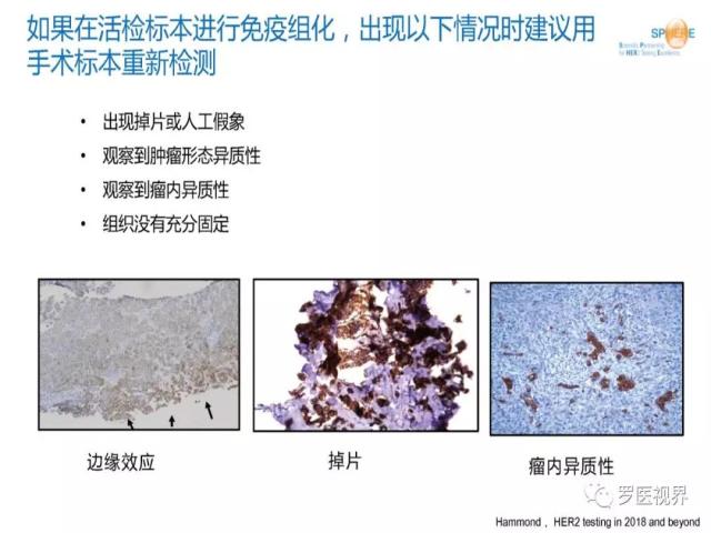 2018 ASCO/CAP乳腺癌HER2检测指南更新解读