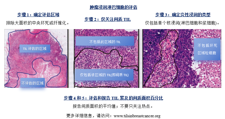 乳腺肿瘤WHO分类学习笔记（连载9）